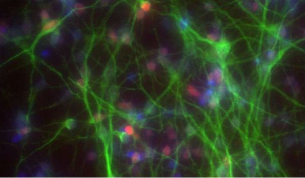 科學家利用CRISPR-Cas9技術成功構建出細胞疾病模型