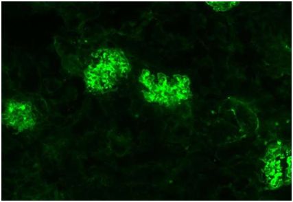 Science：細胞毒性T細胞竟讓<font color='red'>自身免疫疾病</font>更加嚴重！