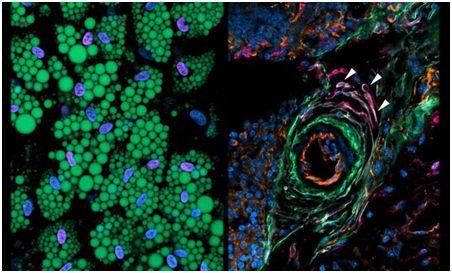 重磅！發現一類控制脂肪細胞產生的細胞亞群