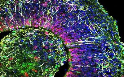 大腦類器官的新型培育方法