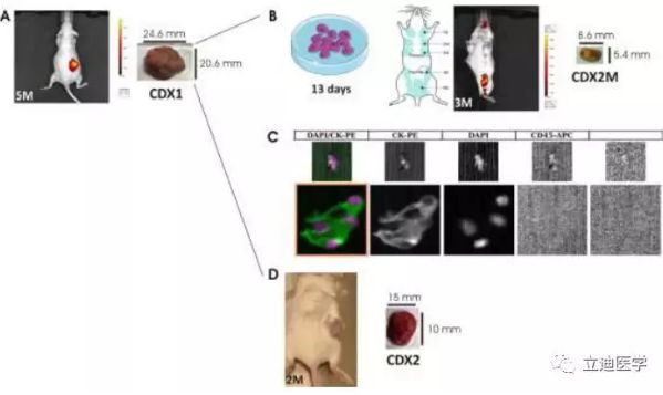 最新研究：科學家借助循環腫瘤細胞移植模型揭示三陰性乳腺癌的轉移機制