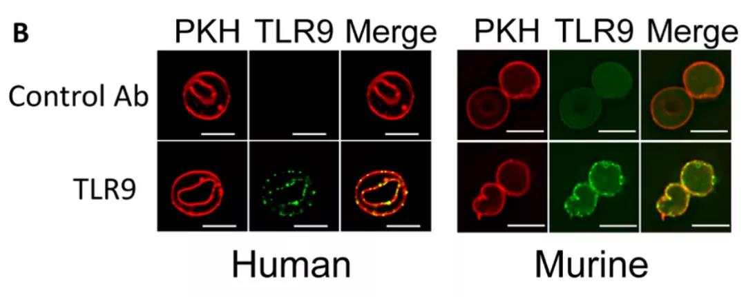圖注：研究者們分別利用熒光標記了細胞膜（綠色）和TLR9（紅色）證明了人和小鼠體內TLR9在紅細胞膜上的表達，人和小鼠紅細胞膜上的TLR9表達