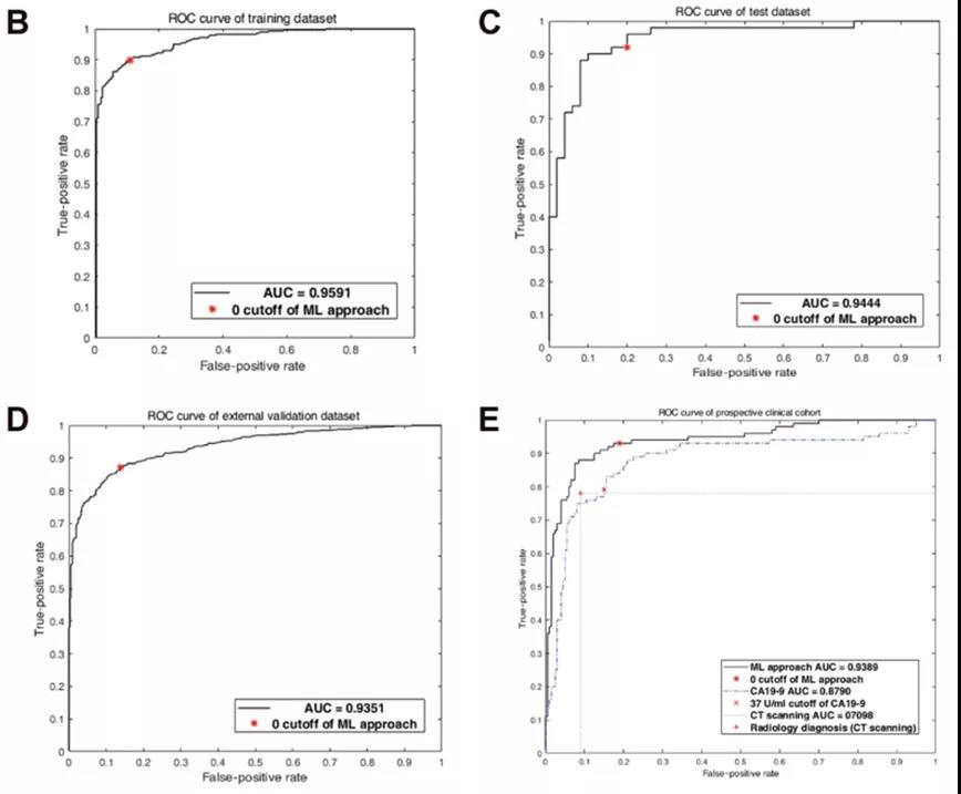 ML輔助代謝型PDAC檢測方法在驗證研究訓練數據集&內部驗證數據集&外部驗證數據集&前瞻性臨床隊列中的ROC曲線（圖源：Science Advances）