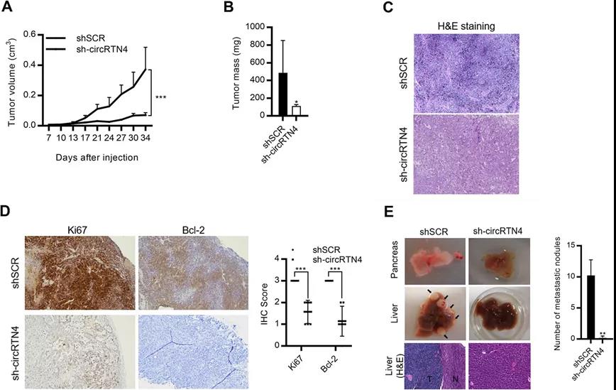 circRTN4促進PDAC腫瘤生長和肝轉移（圖源: Molecular Cancer）