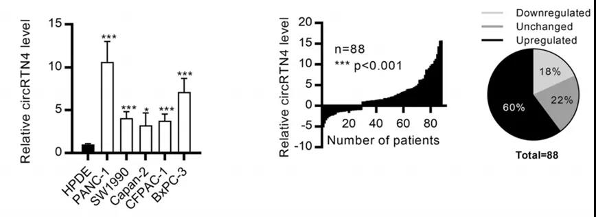  circRTN4在PDAC細胞和原發性腫瘤中上調（圖源: Molecular Cancer）   