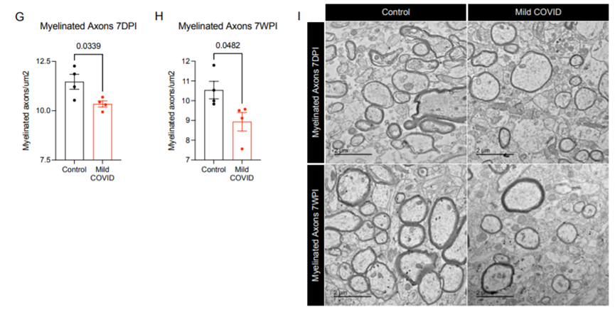 小鼠胼胝體髓軸突的定量變化及代表性的透射電子顯微鏡圖像（圖源：bioRxiv）