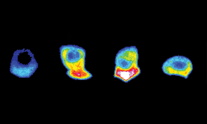 Developmental Cell：為入侵細胞的“前線”提供燃料