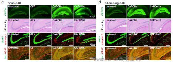 Nat Commun：<font color='red'>阿爾茲海默癥</font>病理蛋白與小鼠的細(xì)胞死亡有關(guān)