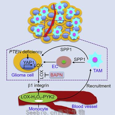 Cancer Cell：揭示巨噬細胞支持PTEN缺陷膠<font color='red'>質母細胞瘤</font>的機制！