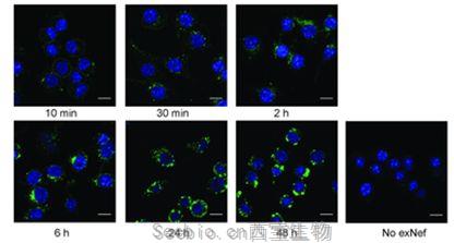 PLoS Pathog：揭示<font color='red'>HIV感染</font>如何導(dǎo)致心臟病、糖尿病和癡呆癥等一系列慢性疾病