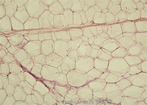 J Clin Endocrinol Metabol：增加體育鍛煉并不能改善<font color='red'>棕色脂肪組織</font>的功能