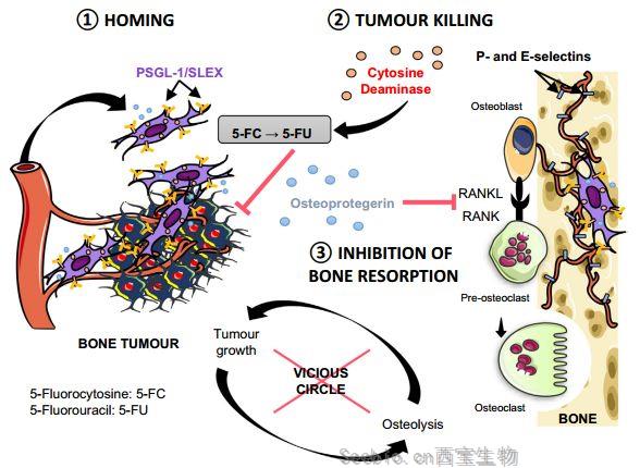 EBioMedicine：研究人員開發出以骨轉移為靶點、同時保留骨組織的癌癥<font color='red'>治療</font>方法