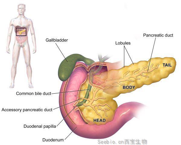 Cell Metab意外發現：胰腺癌可能是胰島素水平過高導致！