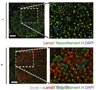 Nature：科學家用CRISPR成功治療肌營養不良癥