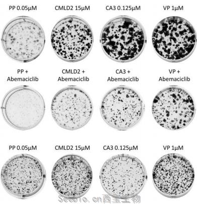 Mol Cancer Res：克服胰腺癌耐藥，新藥組合讓癌癥之王低頭認輸