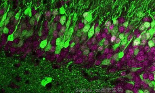 Nat Neurosci：獨特的指紋印記或讓神經細胞變得與眾不同