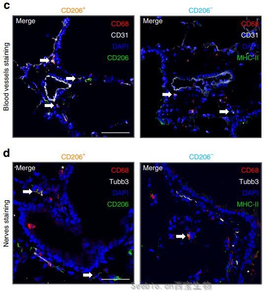 Nat Commu重大突破：發(fā)現(xiàn)全新的肺部免疫細胞
