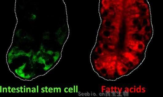 Gastroenterology：關鍵的腸道干細胞基因或能將<font color='red'>膳食脂肪</font>與結腸癌風險聯系起來