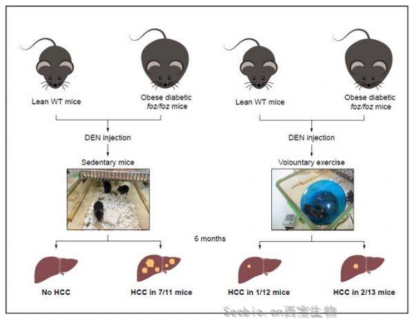 J Hepatol： 好消息！新研究表明運(yùn)動(dòng)可以幫助預(yù)防肝癌！