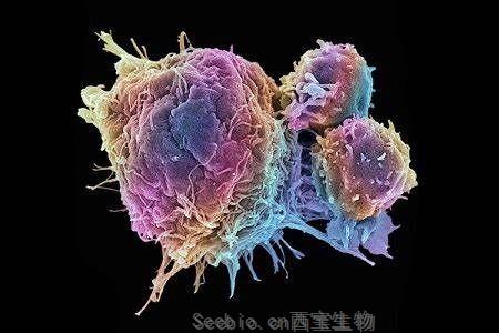 Nature Cancer 阻斷腫瘤信號可以阻止癌癥的擴散