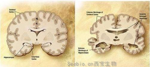 Nat Commun：揭秘毒性<font color='red'>tau蛋白</font>在阿爾茲海默病患者大腦中擴散的分子機制