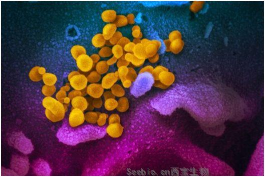 Science：發現有潛力治療COVID-19的強效抗體組合