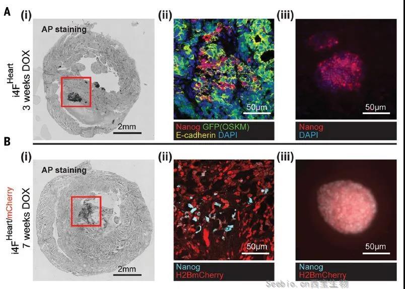 Science重磅：局部重編程讓心肌細胞“<font color='red'>返老還童</font>” 讓心臟實現再生！