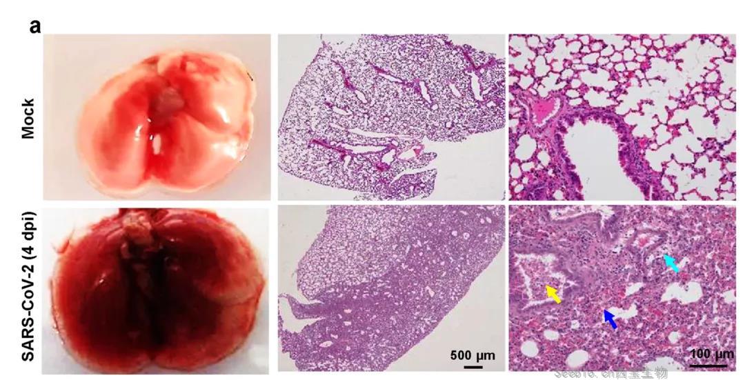 建模成功！Nature子刊：成功建立新冠肺炎重癥模型，揭示新冠病毒感染的分子機(jī)制