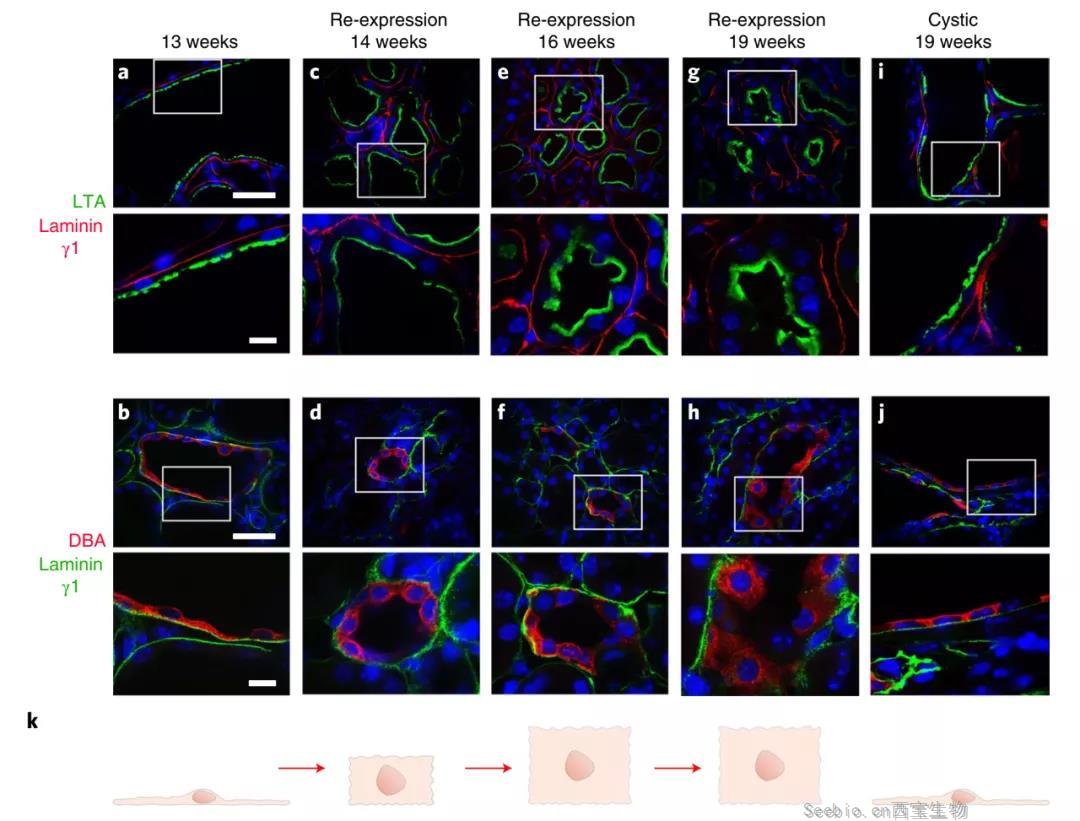 無需腎移植！Nature子刊：科學家通過逆轉小鼠<font color='red'>多囊腎</font>病揭示腎臟的可塑性