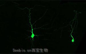 《Cell》發育中的神經細胞利用必需氨基酸的機制