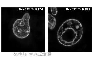 Nature子刊：線粒體疾病中發現類似衰老和癌癥的機制