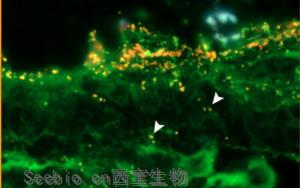 PNAS新研究：致病菌利用腸道黏液層中的一種糖來感染腸道