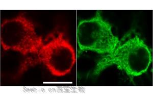 《PNAS》從過度反應蛋白合成到認知障礙，敲除1個基因即可