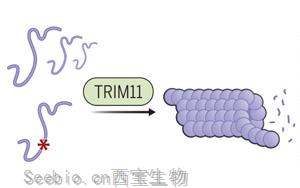 Science：第一次確定了監督tau功能的基因