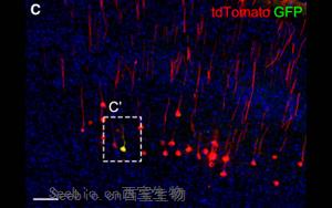 《Neuron》科學家發現腦力更新的<font color='red'>生物標志物</font>