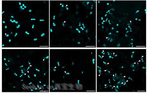 Science Advances：葉綠體的作用不僅僅是光合作用！免疫防御中隱藏的玩家