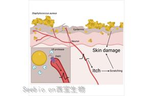 Cell：首次證明一種常見的皮膚細(xì)菌可以通過直接作用于神經(jīng)細(xì)胞而引起瘙癢