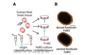 《Cell》新型組織衍生的大腦類器官可能會給大腦研究帶來革命性的變化