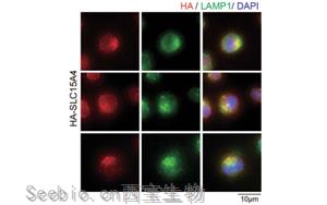 Nature子刊：開創性的將化學探針引入活細胞，靶向紅斑狼瘡