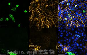 Nature最新研究表明，一類新的抗病毒藥物可以對抗<font color='red'>SARS-CoV</font>-2