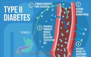 Nature Medicine：2型糖尿病的多祖先多<font color='red'>基因</font>機制