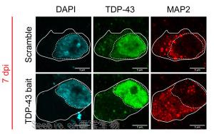 Cell Stem Cell：利用類器官保護癡呆和ALS中受到的腦損傷