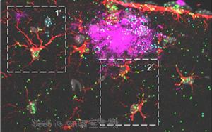 《Nature Neuroscience》可增強(qiáng)神經(jīng)膠質(zhì)細(xì)胞的蛋白質(zhì)