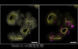 Cell：突破類器官研究限制！利用所有關(guān)鍵的<font color='red'>胰腺細(xì)胞</font>創(chuàng)造了一個新的類器官