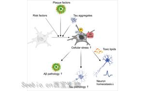 《Neuron》阿爾茨海默氏癥背后隱藏的罪魁禍首：顯微鏡下看小膠質細胞