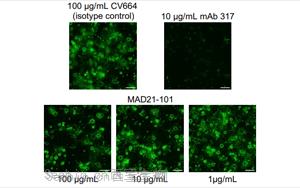 Science：一類全新的抗瘧疾抗體