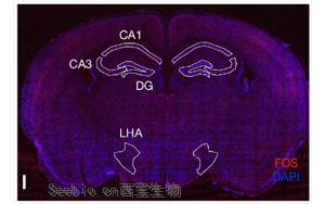 Nature：科學家發現記憶如何控制<font color='red'>新陳代謝</font>