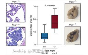 干擾素-r（IFNr）調控軟腦膜抗腫瘤免疫應答的機制研究